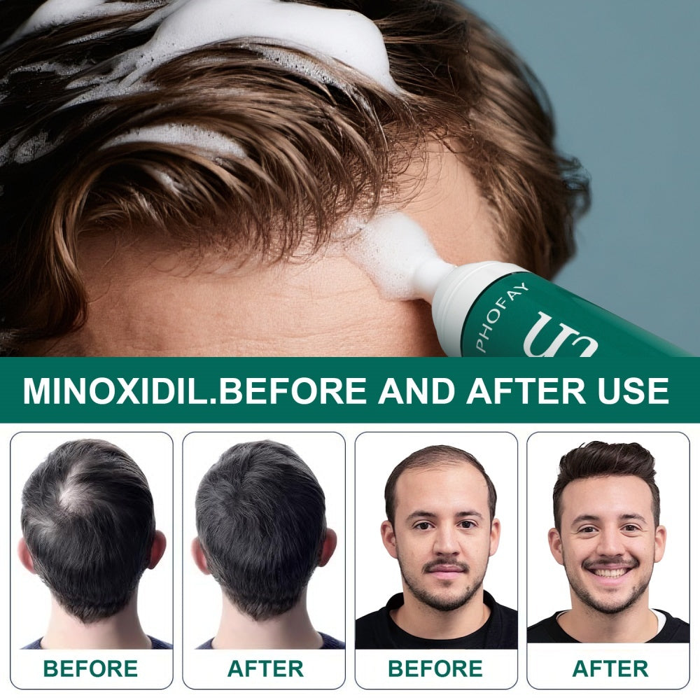 Minoxidil Anti-Hair Loss Mousse - Wellora
